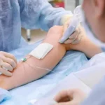 सिंगल यूज मेडिकल डिवाइस के दोबारा इस्तेमाल पर सख्ती, केंद्र ने राज्यों को दिए निर्देश